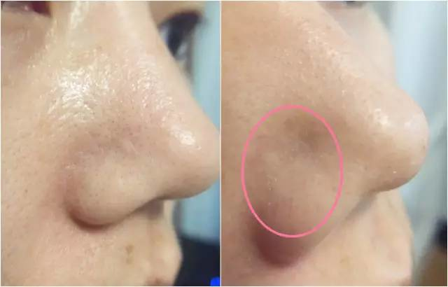 悦诗风吟火山泥面膜，悦诗风吟火山泥面膜多久用一次（亲测8款网红清洁泥膜）