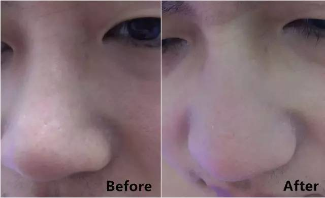 悦诗风吟火山泥面膜，悦诗风吟火山泥面膜多久用一次（亲测8款网红清洁泥膜）