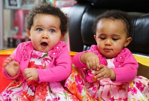 马剑琴和马剑琪，马承祖儿子马剑琴（同卵双胞胎肤色和眼球颜色都不同）