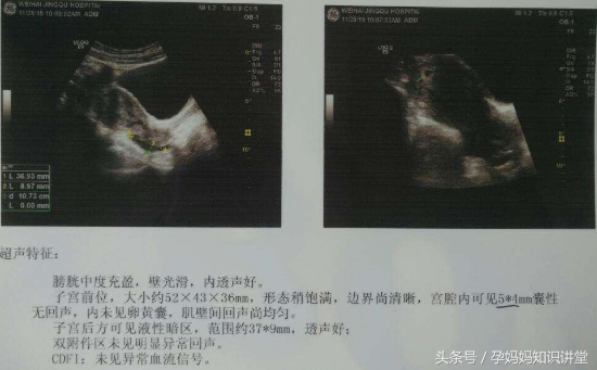6一7周孕囊大小看男女，九个最准怀男孩征兆（学会这六招，宝宝性别算出来）
