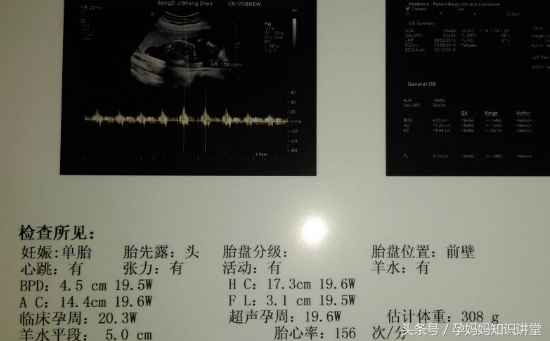 6一7周孕囊大小看男女，九个最准怀男孩征兆（学会这六招，宝宝性别算出来）