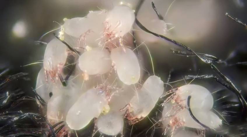 除螨仪吸出来的粉末是什么，除螨仪是智商税吗（你以为晒被子就能杀死螨虫）