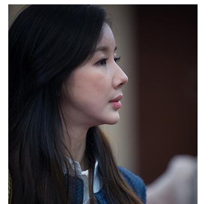 孙菲菲整容后遗症,40岁孙菲菲近照脸太僵(这些都是整容失败的惨痛案例