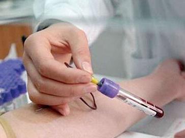 血hcg检查是什么意思，检查血hcg是什么意思（血hcg检查怎么做）