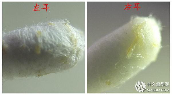 sos医学上是什么意思，医学上的sos是什么意思（人肉亲测德国SOS健康护理8件套）