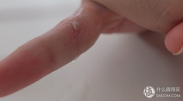 sos医学上是什么意思，医学上的sos是什么意思（人肉亲测德国SOS健康护理8件套）