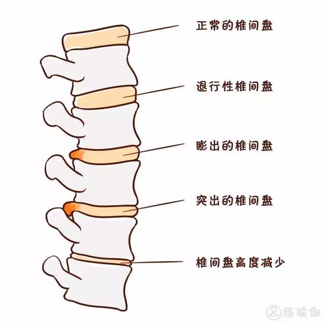 瑜伽可以长高吗，瑜伽能长高吗（练了1年多长高了1.5cm）