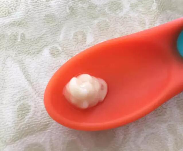 羟基磷酸钙和碳酸钙哪种补钙好，让你的宝宝骨骼健康
