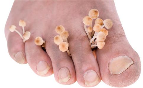 亮甲效果怎么样，亮甲效果怎么样谁用过（知道这5点 一定不会得脚气）