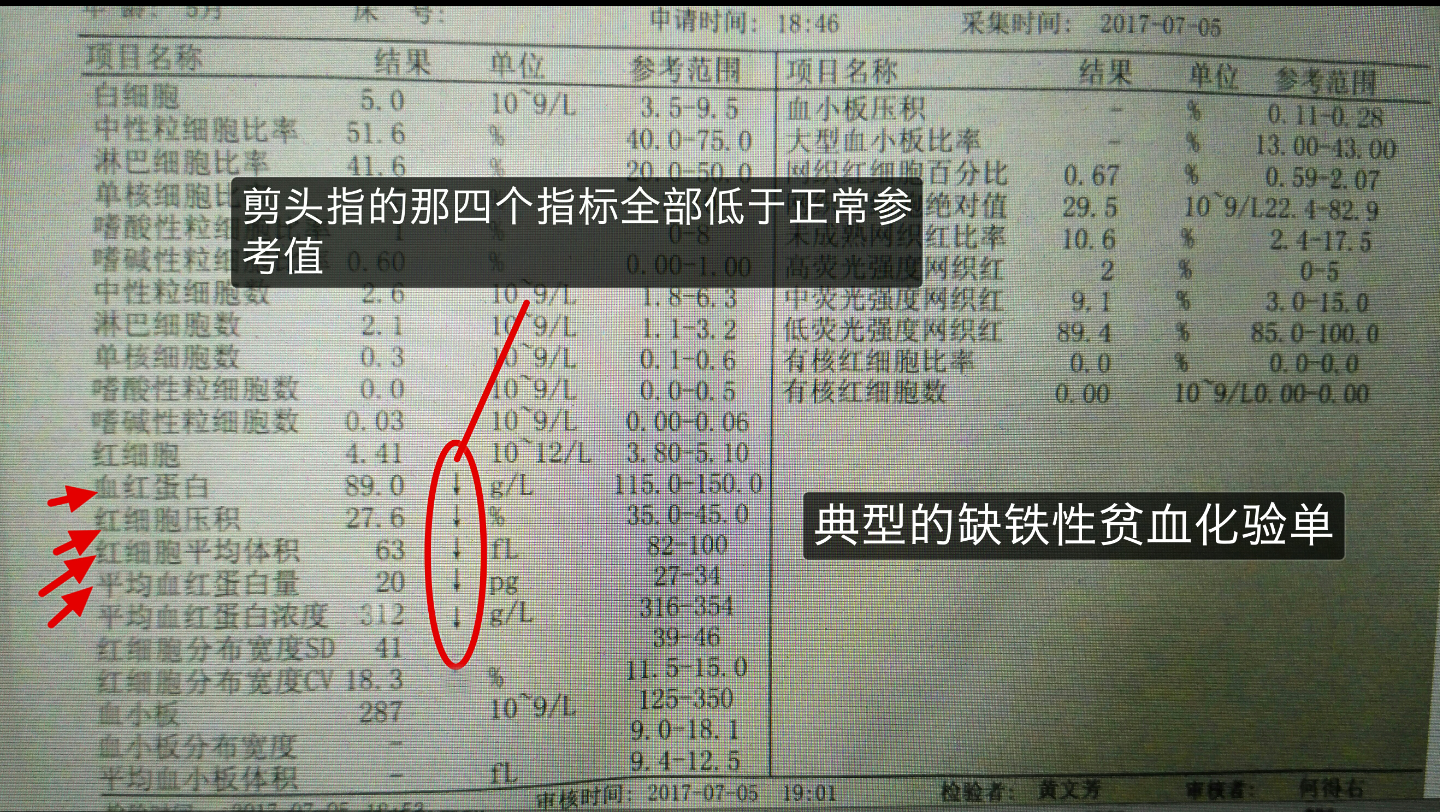 血红蛋白正常值是多少，血红蛋白正常值是多少5岁（如何看血常规报告单第一篇）