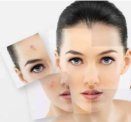 生活小妙招帮你解决顽固痘印，顽固痘印怎么消除（再顽固不化的痘印）