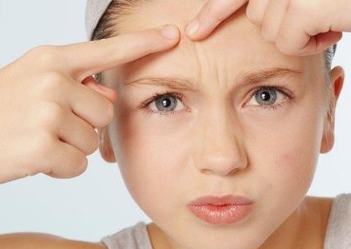 生活小妙招帮你解决顽固痘印，顽固痘印怎么消除（再顽固不化的痘印）