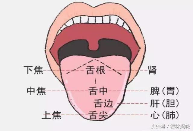一,如何判断孩子上火?