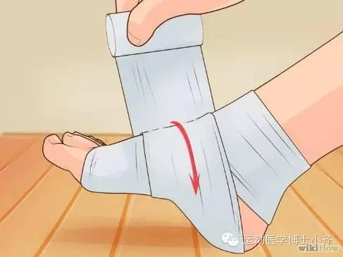 绷带包扎法六种，绷带包扎法包括（踝关节之弹力绷带包扎法）