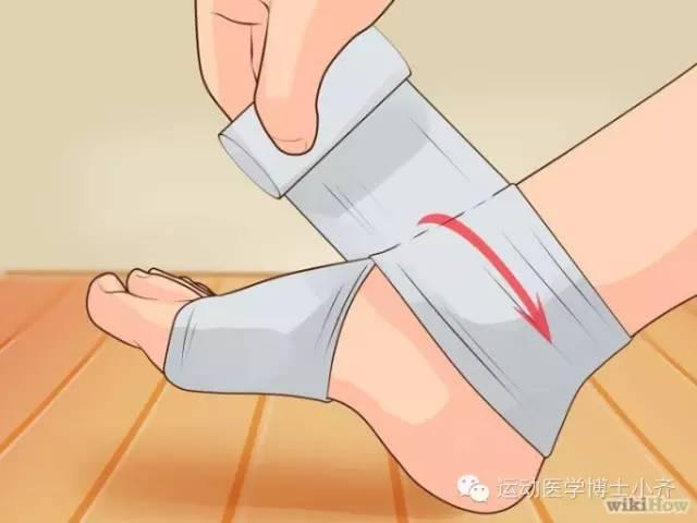 绷带包扎法六种，绷带包扎法包括（踝关节之弹力绷带包扎法）