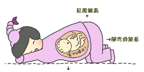 影响胎位不正的因素(哪些因素会导致胎位不正?该如何纠正?