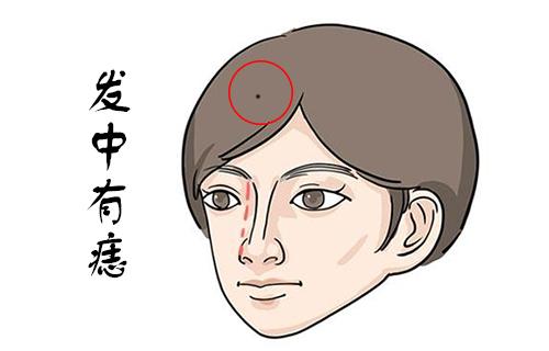 尤其头发里面的痣,更是代表了吉利,是好的征兆,若是在鬓角里的痣,则