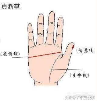 双手断掌纹的男人命运(男性两只手都是断掌是好是坏) - 珍缘易学