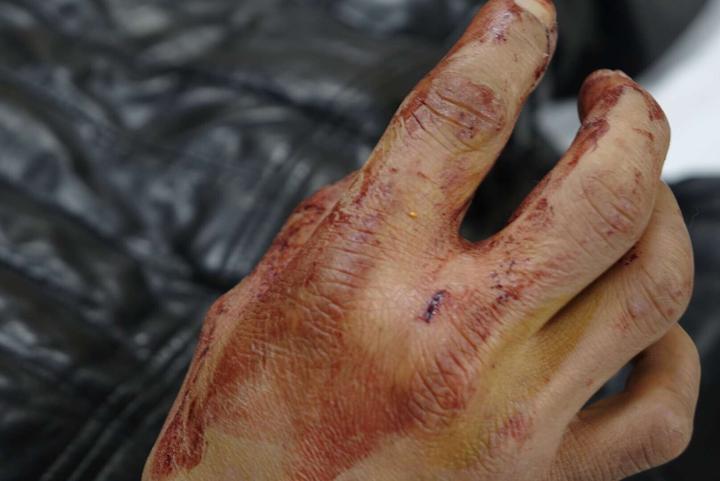 梦到眼镜蛇咬人,大过年的竟有毒蛇出没 - 玉三网