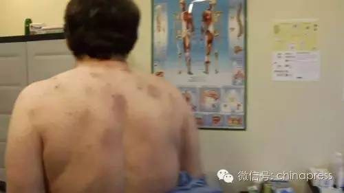 勺子杀人狂完整版，勺子杀手解说（他花了12年用一把勺子来杀人）