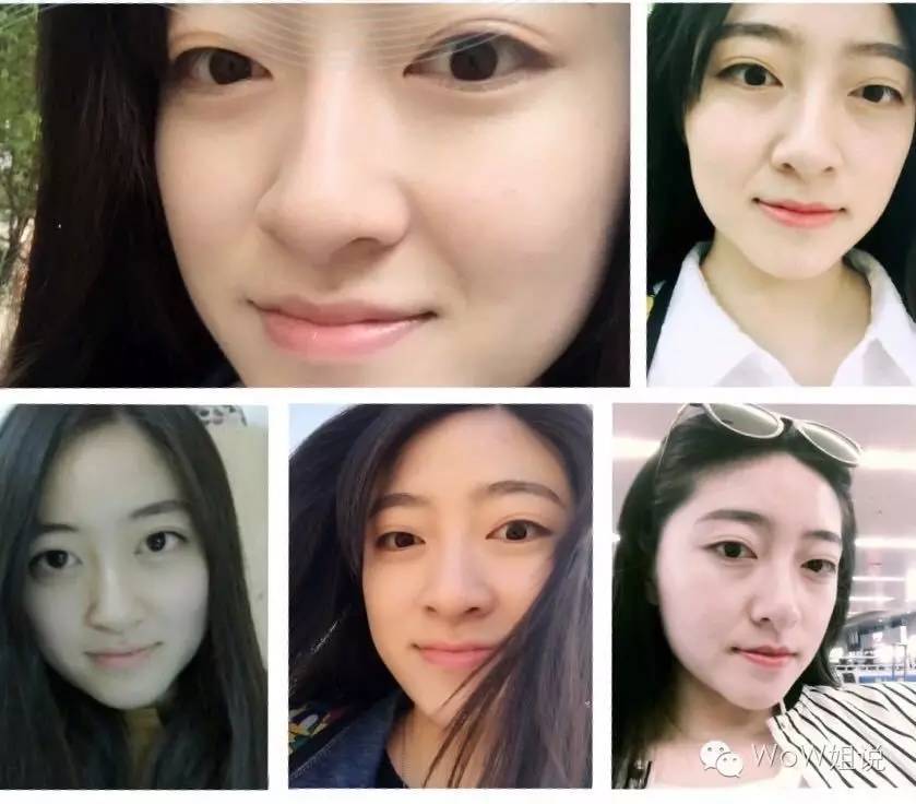 接骨木眼胶，眼部保养tips都在这里了（接骨木眼胶好用吗）