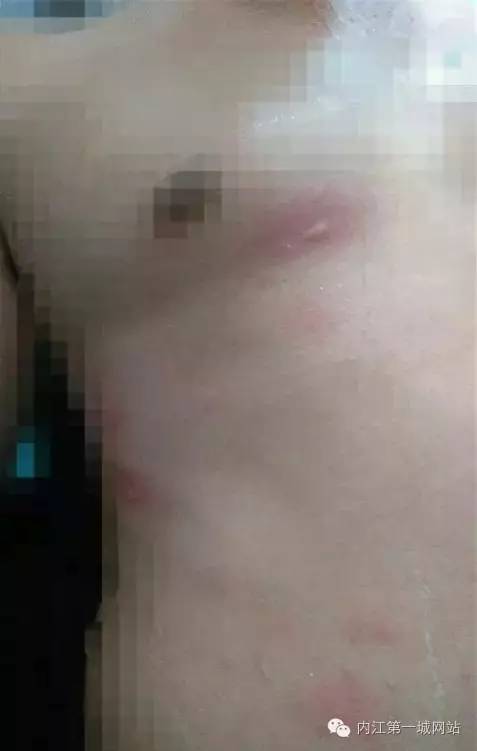 关于茶黄毒蛾介绍，黄绿枯叶蛾有毒吗（内江威远惊现黄色有“毒”飞蛾）