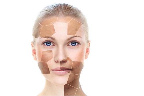 马齿苋祛痘方法，马齿苋能治痘痘吗（这场“战痘”必胜无疑）