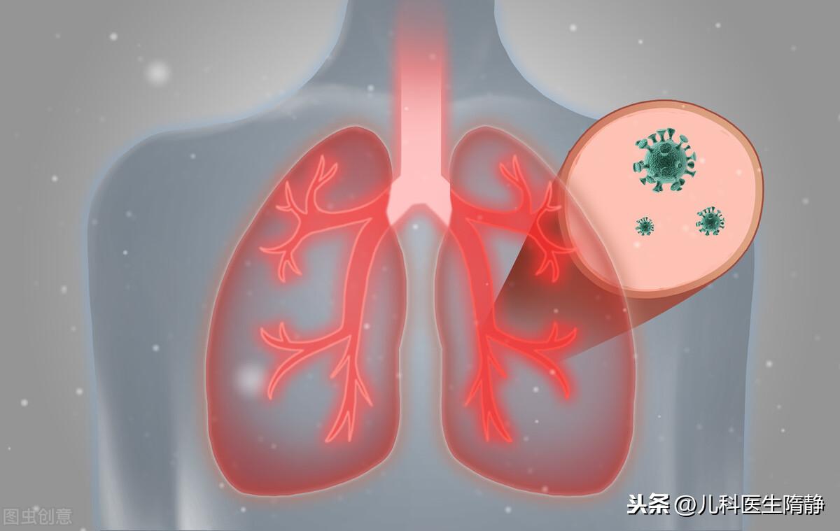 小儿支气管肺炎怎么引起的(小儿支气管肺炎如何治疗)