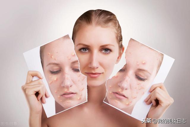 洗脸后护肤步骤，护肤的正确流程应该是怎样的（三分钟带你了解正确的护肤姿势）