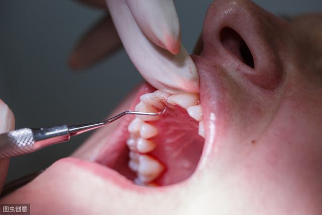 喝热水牙疼是什么原因，引起牙疼的原因有哪些（其实是牙髓炎在作祟）