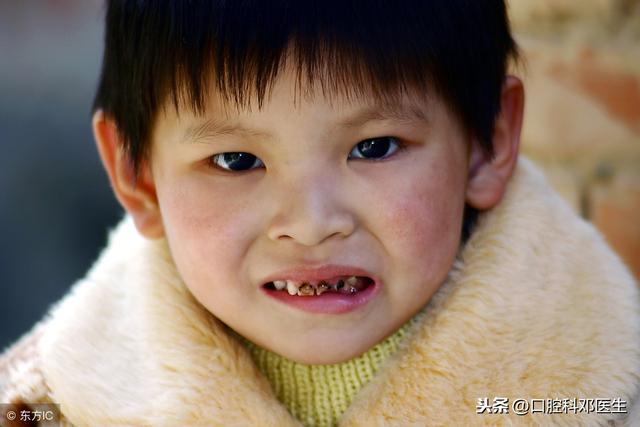 小孩几岁换牙齿的年龄，儿童几岁开始换牙（父母有不可推卸的责任）