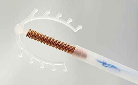 取环的最佳时间，取环的最佳年龄是什么时候（妇女什么时候取环好）