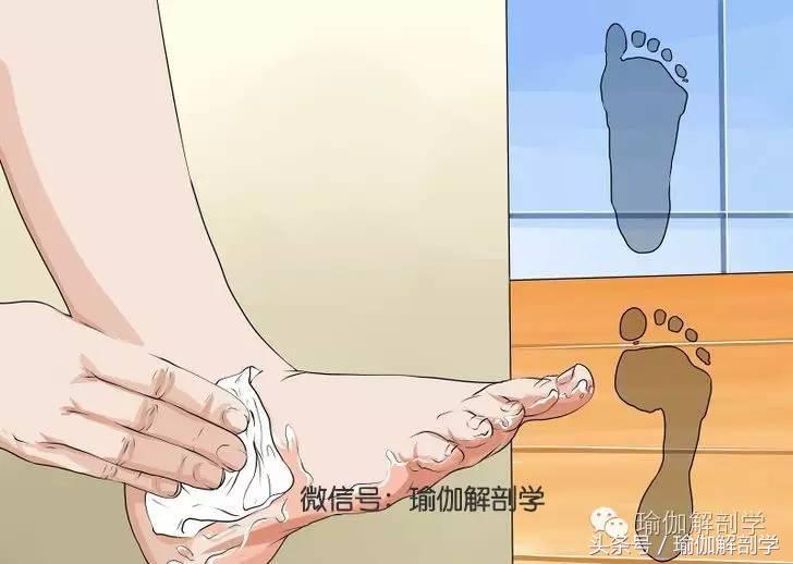 扁平足怎么治疗，扁平足如何治疗和恢复（如何治疗平足Ⅰ——了解平足的类型）