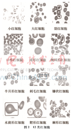 透射电镜图，透射电镜可以分析什么（红细胞SEM图像的三维重构及形状特征提取）