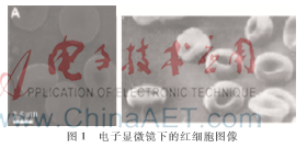 透射电镜图，透射电镜可以分析什么（红细胞SEM图像的三维重构及形状特征提取）