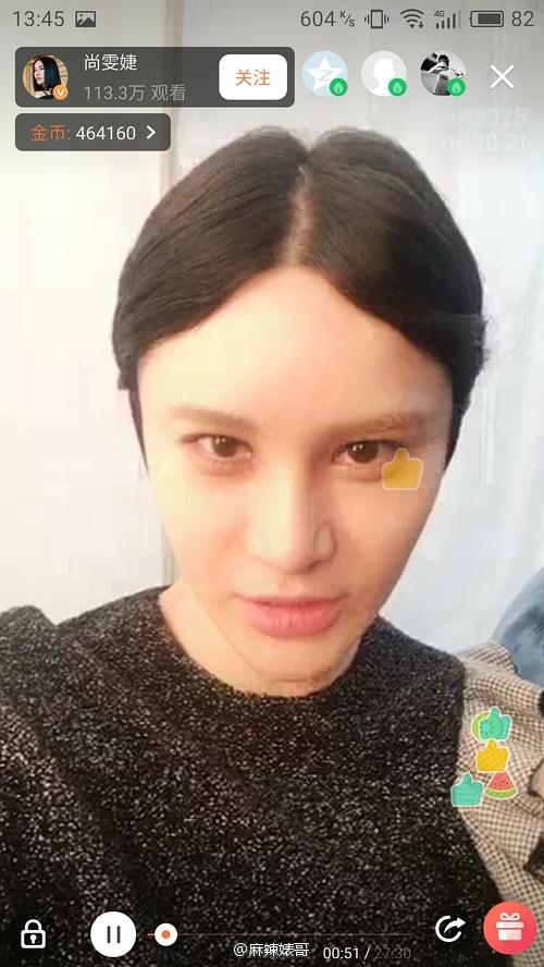 尚雯婕整容前后照片，超女整容死亡（号称没整容的尚雯婕却把人吓毁了）