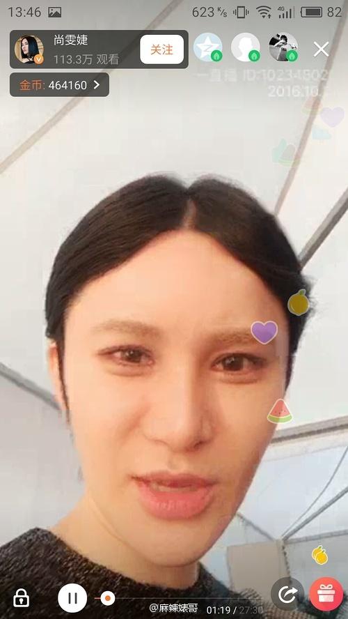 尚雯婕整容前后照片，超女整容死亡（号称没整容的尚雯婕却把人吓毁了）