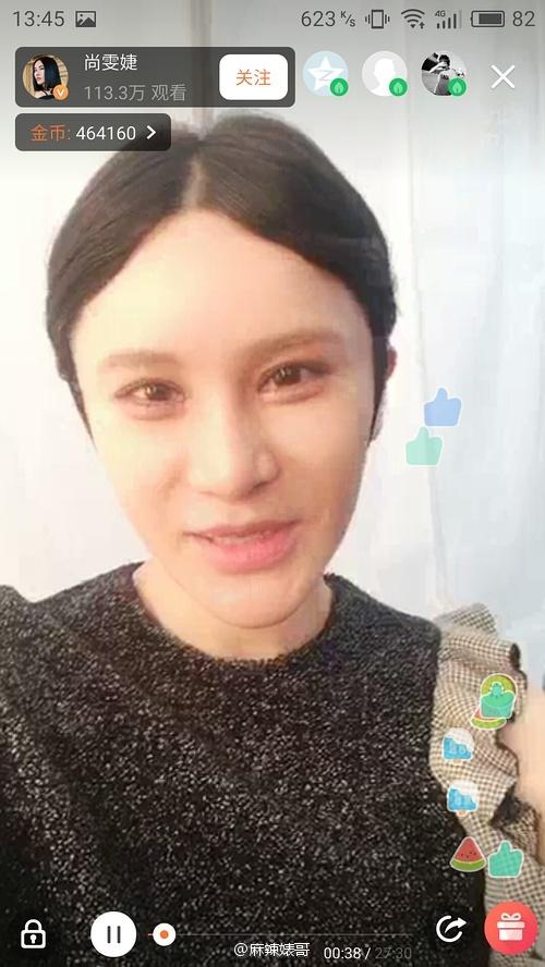 尚雯婕整容前后照片，超女整容死亡（号称没整容的尚雯婕却把人吓毁了）