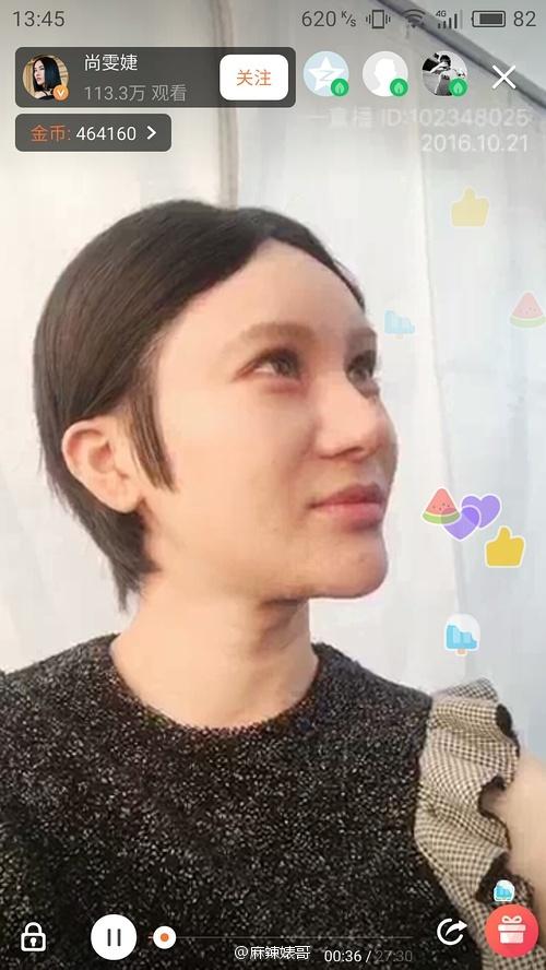 尚雯婕整容前后照片，超女整容死亡（号称没整容的尚雯婕却把人吓毁了）