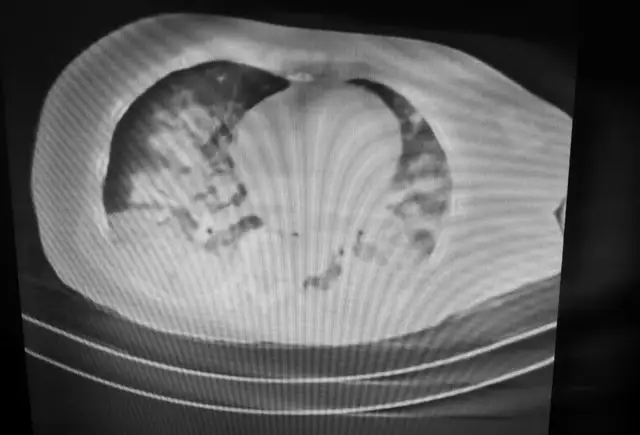 湘潭县人民医院：溺水高发季，我们在行动