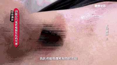 刮痧之后可以涂抹身体乳吗