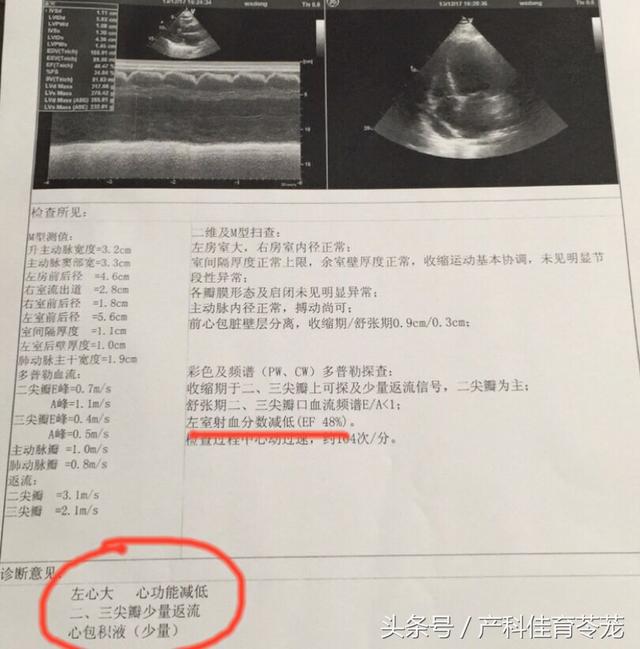 怀孕咳嗽怎么办