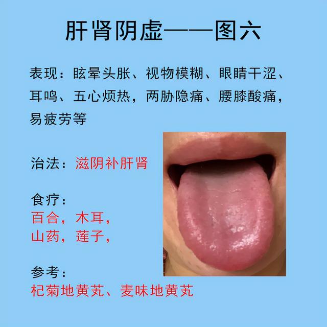 肝脏不好的七种表现，以及对应舌象和解决方法，养肝刻不容缓