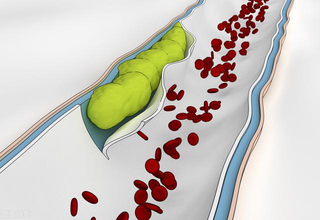 常喝丹参泡水，这5个问题一定要搞清楚