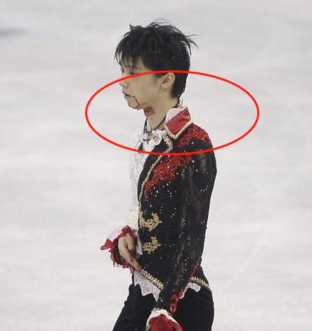 闫涵和日本选手羽生结弦因为这猝不及防的一撞差点让两人把命都交代了