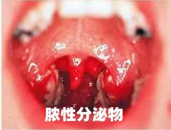 脖子皮肤像鸡皮是hpv吗