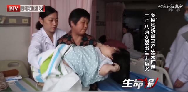 身高89厘米，体重58斤，“玻璃”妈妈冒死生下女儿！纪录片