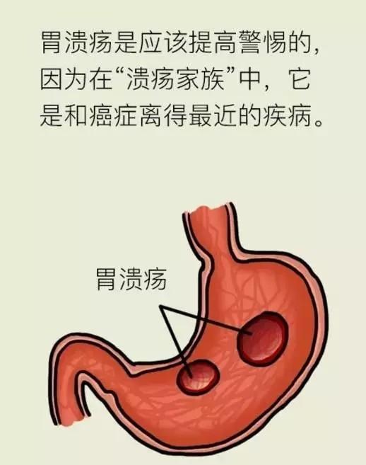 饭后肚子疼是怎么回事