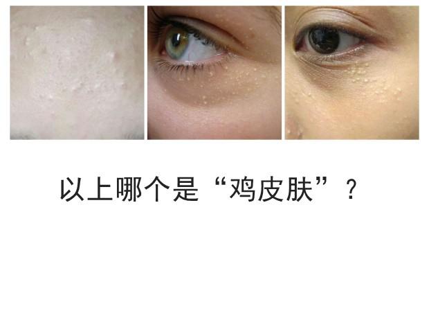 delon身体乳会长毛吗