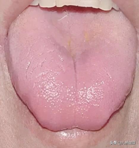 这颗养血果，可以让女人气色红润好睡眠